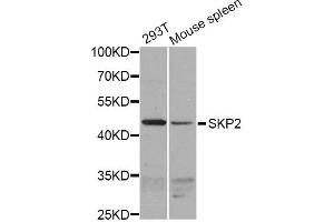 Western blot analysis of extracts of various cell lines, using SKP2 antibody (ABIN1874793) at 1:1000 dilution. (SKP2 anticorps)