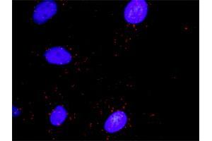 Proximity Ligation Analysis of protein-protein interactions between RHOA and DAAM1.