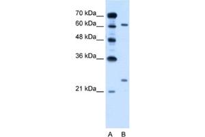 Western Blotting (WB) image for anti-RAR-Related Orphan Receptor A (RORA) antibody (ABIN2462863) (RORA anticorps)