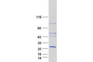 Validation with Western Blot