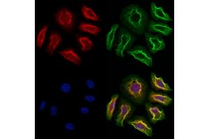 ABIN6262909 and ABIN6273260 staining Hela cells by IF/ICC. (LAPTM4B anticorps  (Internal Region))