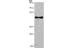Western blot analysis of Human fetal brain tissue, using FADS1 Polyclonal Antibody at dilution of 1:300 (FADS1 anticorps)