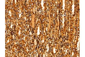 Phospho-PHD2 (Ser125) Antibody at 1/100 staining Rat kidney tissue by IHC-P. (EGLN1 anticorps  (pSer125))