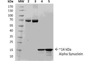 SDS-PAGE of ~14 kDa Human Recombinant Alpha Synuclein Protein Monomer (Control) .