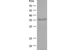 Western Blotting (WB) image for Acetyl-CoA Acyltransferase 2 (ACAA2) (AA 17-397) protein (His-IF2DI Tag) (ABIN7121643)