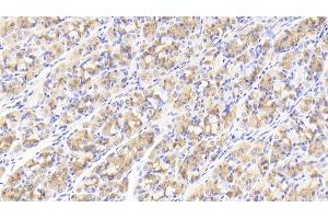 Detection of GDF5 in Human Stomach Tissue using Polyclonal Antibody to Growth Differentiation Factor 5 (GDF5) (GDF5 anticorps  (AA 382-501))