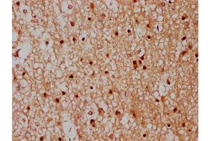 IHC image of ABIN7148527 diluted at 1:300 and staining in paraffin-embedded human brain tissue performed on a Leica BondTM system.