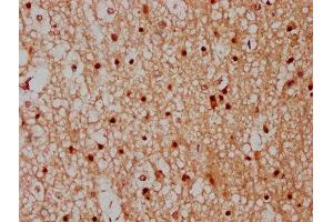 IHC image of ABIN7148527 diluted at 1:300 and staining in paraffin-embedded human brain tissue performed on a Leica BondTM system. (CPNE7 anticorps  (AA 254-393))