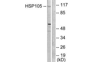 Western Blotting (WB) image for anti-Heat Shock 105kDa/110kDa Protein 1 (HSPH1) (C-Term) antibody (ABIN1848610) (HSPH1 anticorps  (C-Term))