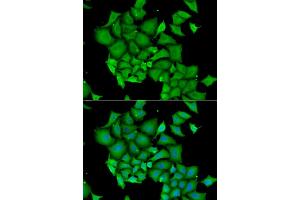 Immunofluorescence analysis of HeLa cells using DFFA antibody. (DFFA anticorps)