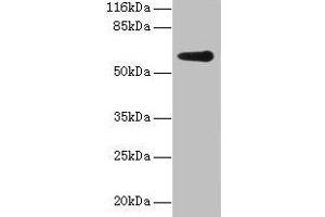 Western blot All lanes: GK2 antibody at 2 μg/mL + Jurkat whole cell lysate Secondary Goat polyclonal to rabbit IgG at 1/10000 dilution Predicted band size: 61 kDa Observed band size: 61 kDa (GK2 anticorps  (AA 2-553))