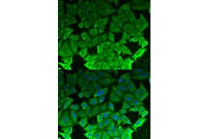 Immunofluorescence analysis of MCF-7 cells using EEF2K antibody. (EEF2K anticorps)