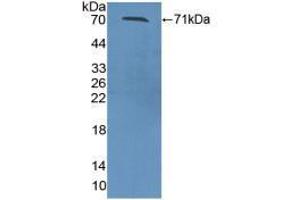Western blot analysis of recombinant Mouse ZPI. (SERPINA10 anticorps  (AA 22-448))