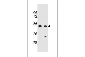 Western blot analysis in CEM,A549 cell line lysates (35ug/lane). (RFWD2 anticorps  (N-Term))