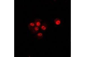 Immunofluorescent analysis of CIP4 staining in U2OS cells.