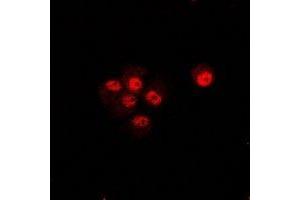 Immunofluorescent analysis of CIP4 staining in U2OS cells. (TRIP10 anticorps)