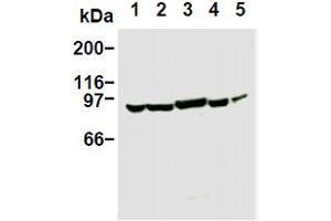 Western Blotting (WB) image for anti-Phosphoinositide 3 Kinase, p85 alpha (PI3K p85a) antibody (ABIN1108652) (PIK3R1 anticorps)