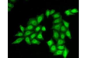 Immunofluorescence analysis of HeLa cells using SSRP1 Polyclonal Antibody (SSRP1 anticorps)