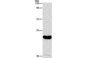 Western blot analysis of Human normal liver tissue, using BAAT Polyclonal Antibody at dilution of 1:600