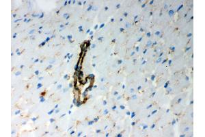 IHC analysis of BAK using anti-BAK antibody .