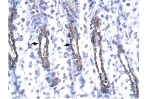 MMP19 antibody was used for immunohistochemistry at a concentration of 4-8 ug/ml to stain Epithelial cells (arrows) in Human Urinary bladder. (MMP19 anticorps  (N-Term))