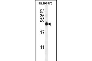 S3 Antibody (N-term) 0390a western blot analysis in mouse heart tissue lysates (35 μg/lane). (AP1S3 anticorps  (N-Term))
