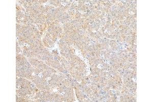 Immunohistochemistry (IHC) image for anti-Coatomer Protein Complex, Subunit beta 2 (COPB2) (AA 856-906) antibody (ABIN7453569)