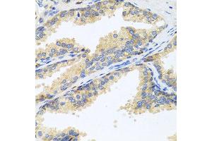 Immunohistochemistry of paraffin-embedded human prostate using WFDC2 antibody at dilution of 1:100 (40x lens). (WFDC2 anticorps)