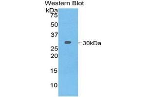 Detection of Recombinant TUBb6, Mouse using Polyclonal Antibody to Tubulin Beta 6 (TUBb6)