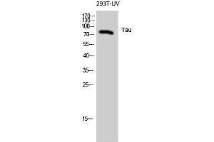 Western Blotting (WB) image for anti-tau Protein (Ser824) antibody (ABIN3177619) (tau anticorps  (Ser824))