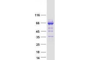Validation with Western Blot (UBASH3A Protein (Transcript Variant 2) (Myc-DYKDDDDK Tag))