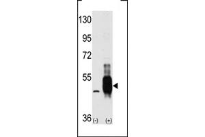 Western blot analysis of MEKK8 using MEKK8 Antibody using 293 cell lysates (2 ug/lane) either nontransfected (Lane 1) or transiently transfected with the MAP3K8 gene (Lane 2).