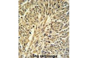 Immunohistochemistry (IHC) image for anti-IMP (Inosine 5'-Monophosphate) Dehydrogenase 2 (IMPDH2) antibody (ABIN3003184) (IMPDH2 anticorps)