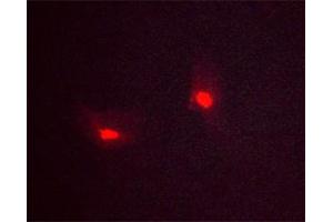 ABIN6267288 staining Mv1Lu cells treated with hydroxyurea(20 mM,16h) by ICC/IF.