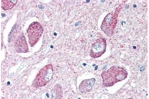 Human Brain, Basal Nucleus of Meynert (formalin-fixed, paraffin-embedded) stained with WNT8B antibody ABIN351424 at 10 ug/ml followed by biotinylated goat anti-rabbit IgG secondary antibody ABIN481713, alkaline phosphatase-streptavidin and chromogen. (WNT8B anticorps  (Internal Region))