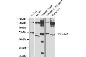 Western blot analysis of extracts of various cell lines, using PIP4K2A antibody (ABIN6130624, ABIN6145673, ABIN6145674 and ABIN6223324) at 1:1000 dilution. (PIP4K2A anticorps  (AA 120-350))