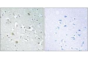 Immunohistochemistry analysis of paraffin-embedded human brain, using PLA1A Antibody. (PLA1A anticorps  (AA 381-430))