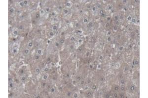 anti-Symplekin (SYMPK) (AA 1-347) antibody