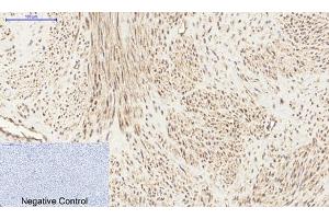 Immunohistochemical analysis of paraffin-embedded human uterus tissue. (PI3K p85 alpha/gamma anticorps)