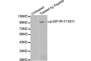 Western blot analysis of extracts from 293 cells, using Phospho-IGF1R-Y1161 antibody (ABIN2988064). (IGF1R anticorps  (pTyr1161))