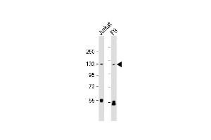 All lanes : Anti-SIRT1 Antibody at 1:1000 dilution Lane 1: Jurkat whole cell lysate Lane 2: F9 whole cell lysate Lysates/proteins at 20 μg per lane. (SIRT1 anticorps  (AA 1-180))