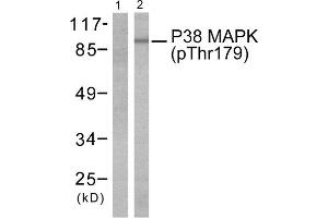 Western blot analysis of extracts from Hela cells treated with TNF- alpha (20ng/ml, 5mins), using P38 MAPK (phospho-Thr180) antibody (Line 1 and 2). (MAPK14 anticorps  (pThr180))