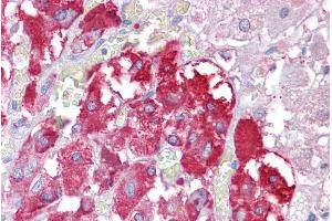 anti-Transmembrane Phosphatase with Tensin Homology (TPTE) (Internal Region) antibody