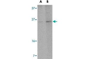 Western blot analysis of RCAN2 in NIH/3T3 cell lysate with RCAN2 polyclonal antibody  at (A) 1 and (B) 2 ug/mL . (RCAN2 anticorps  (Internal Region))