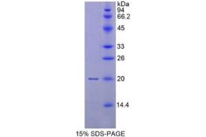 SDS-PAGE of Protein Standard from the Kit  (Highly purified E. (MMP 9 Kit ELISA)