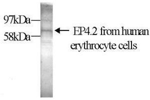 Western Blot (10% gel) with the anti-transglutaminase antibody EP4. (EPB42 anticorps)