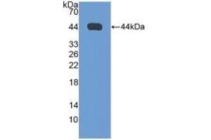 Detection of Recombinant NPPA, Rat using Polyclonal Antibody to Natriuretic Peptide Precursor A (NPPA) (NPPA anticorps  (AA 25-152))