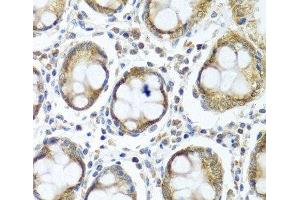 Immunohistochemistry of paraffin-embedded Human colon using IFI44 Polyclonal Antibody at dilution of 1:100 (40x lens). (IFI44 anticorps)