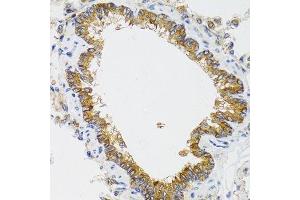 Immunohistochemistry of paraffin-embedded rat lung using CHMP4B antibody. (CHMP4B anticorps  (AA 1-224))