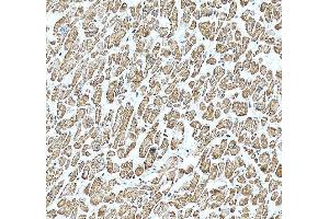 anti-Actinin, alpha 2 (ACTN2) (AA 567-696) antibody